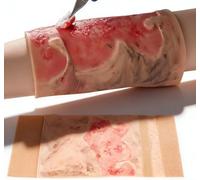 GFLCWYP Simulated Burn Wound Model,2-3 Degree Limb Burns Training Module, Wearable Wound Skin Model,Burn Care Training,Medical Teaching Demonstration,for Medical Education