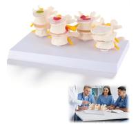 GFLCWYP Spine Lumbar Disc Herniation Model,Human Spine Anatomical Model, Human Spine Model 4-Stage,Skeleton Intervertebral Disc Herniation Model for Learning and Education