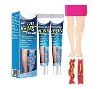 GFOUK Mucopolysaccharide Polysulfate Cream, Varicose Veins Cream, Improve Blood Circulation, Legs Care Cream,Varicose Veins Treatment for Legs (2PC)