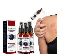 GFOUK Natural Eczema Therapy Spray,All Natural Eczema Treatment,Psoriasis Treatment,Vitiligo Skin Repair Spray,Skin Care Pain & Itch Spray,Fast Acting Itch Relief (3 Pcs)