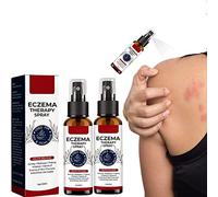 GFOUK Natural Eczema Therapy Spray,All Natural Eczema Treatment,Psoriasis Treatment,Vitiligo Skin Repair Spray,Skin Care Pain & Itch Spray,Fast Acting Itch Relief (2 Pcs)