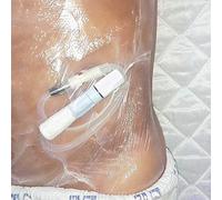 GHzzY Dressings 100 Pieces Disposable Shower Shield, Transparent Catheter Protection Adhesive, Sterile Wound Dressing Barrier Shower Cover(15 * 15cm), 200.0 grams