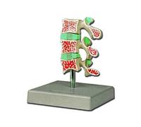 Gima - Anatomical Model of 3 Vertebrae with Advanced Osteoporosis, Highly Detailed, Magnification 1X