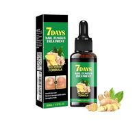 Ginger Nail Treatment, Natural Nail Repair Serum Treatment, 7 Days Nail Treatment for Toenail, Ginger Cuticle Care Oil for Nails, Repair Nails a Natural Shine (30 ml (Pack of 1))