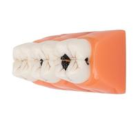 GIQKDZNUO Dental 4X Dental Caries Evolution Model, Decomposition of Tooth Decay and Caries Process4 Times Pathology Decayed Tooth Model for Teaching Learning