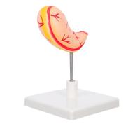 GLEAVI Human Stomach Anatomy Model Realistic Teaching Aid for User Friendly Design for Easy Assembly for Classroom and Clinical Use Promotes Understanding of Stomach Functions and