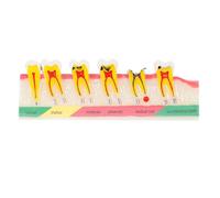 GLEAVI Oral Education Tooth Model for Students Resin PVC Teaching Aid | High Strength Build, Portable Instruction, Classroom Demos, Patient Consultation, Restoration Treatments