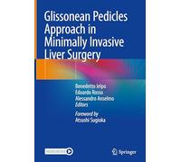 Glissonean Pedicles Approach in Minimally Invasive Liver Surgery