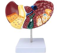 GOOBIX Life Size Anatomy Liver Model Human With Base, Liver Pathology Teaching Model,Clear Pathological Features Liver Cancer Model For Teaching Demonstration