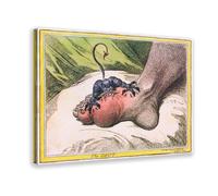 Gout A 1799 Caricature by James Gillray Alcohol Alcoholism Canvas Art Poster And Wall Art Picture Print Modern Family Bedroom Decor 12x18inch(30x45cm)