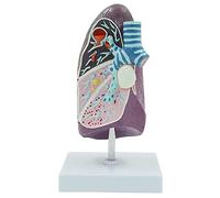 GPDNBIEU Anatomical Models, Pathological Lung Anatomical Model, 2/3 Life Size Human Anatomical Model for Medical Research Demonstration Teaching - Doctor-Patient Communication