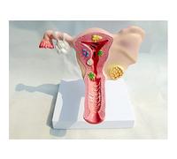 GPDNBIEU Anatomical Models, Uterine And Ovaries Female Genital Organ Female Anatomical Model Gynecology Ovaries and Uterus Model for Medical Education