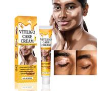 Grgowe Vitiligo Cream, White Spot Cream, Vitiligo Cream for White Spots, Vitiligo Cream, Vitiligo Skin Care Balm, Vitiligo Cream, Repigmentation Cream for White Skin Spots and Vitiligo