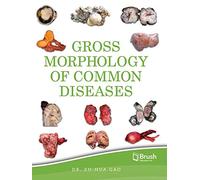 Gross Morphology of Common Diseases