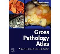 Gross Pathology Atlas – A Guide to Gross Specimens Evaluation – Elsevier