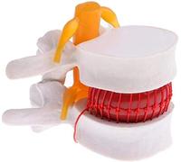 GTHTUHFD 1Pc Human Anatomy Skeleton Spine Lumbar Disc Herniation Brain Skull Pistoltraumatic Weapon Medical Supplies