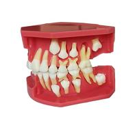 GTHTUHFD Children's Dentition Model - Educational Baby Child Neonatal Teeth Model - Dental Teach Study Child Kid Teeth Model - for Teaching,Practice and Study,E10,7cm (B,B5-7cm