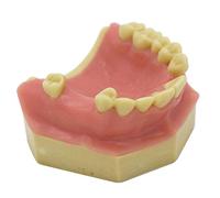 GTHTUHFD Oral Implant Teeth Practice Soft Rubbers Demonstration Tooth Model For Patient Education TRAINING HELP DENTIS REPAIR PLANT TRAINING