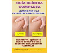 GUÍA CLÍNICA COMPLETA. DERROTAR A LA CELULITIS PARA SIEMPRE. NUTRICIÓN, EJERCICIO, NUEVO ESTILO DE VIDA, TÉCNICAS TERAPÉUTICAS NATURALES BASADO EN ... tu cuerpo. Vive y sana de forma natural)