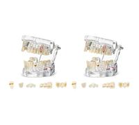 Gvvsjgdbis 2X Disease Teeth Model Dental Typodonts Implant Teeth Model with Removable Teeth Dentist Standard Tooth Demonstration