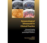 Gynaecological Ultrasound in Clinical Practice: Ultrasound Imaging in the Management of Gynaecological Conditions (Royal College of Obstetricians and Gynaecologists Advanced Skills)