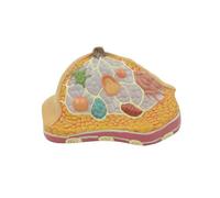 Gynecological Breast Anatomy Model Breast Pathological Anatomy Breast Structure