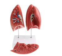 HADECOLL Anatomical Model Human Lung Anatomy Model With Pathologies Anatomy Model Classroom Decoration Science Lab Ornament