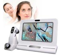 Hair Analyzer Machine - 11 Inch Skin Diagnosis Scalp Detector with 4 Spectral Detection, 50/200 Times Magnification for Hair Follicle Analysis
