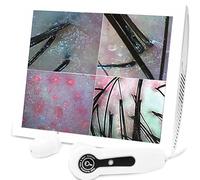 Hair Analyzer Skin Diagnosis Scanner - Digital Microscope for Scalp and Hair Follicle Detection with HD Imaging Technology