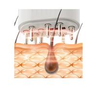 Hair Follicle activator, Electric Hair Growth Oil applicator, Hair Follicle activator, red Light EMS Dual-Effect Care Opens a New era of Scalp Health, Exquisite and Compact Appearance, Easy to Carry