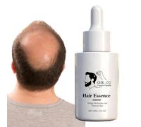 Hair Growth Serums, Hair Growth Nutrient Solution-30ml, Nourishing Scalp Care Ess'ence, Strengthening Hairs Root Growths Liquid Hairs Care Moisturizing Ess'ence Oil