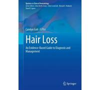 Hair Loss: An Evidence-Based Guide to Diagnosis and Management (Updates in Clinical Dermatology)