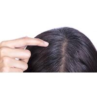 Hair Loss Check-Up