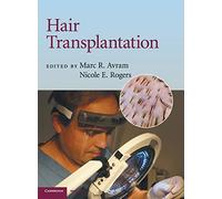 Hair Transplantation (Cambridge Medicine (Hardcover))