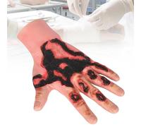 Hand Burn Wound Packing Trainer, Hand Burn Model, Realistic Hand Burn Simulation Skin, Wearable Burn Wound Model for Nursing Training, First Aid & Moulage
