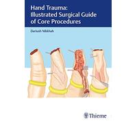 Hand Trauma: Illustrated Surgical Guide of Core Procedures – Thieme