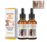 Hand Whitening Essence, Skin Whitening Serum, Dark Skin Whitening Serum, Reduces Hyperpigmentation Age, Removal of Dark Knuckle Fingers, for Knuckle, Elbow, 30 ml x 2G