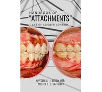 HANDBOOK OF "ATTACHMENTS": ART OF ALIGNER CONTROL