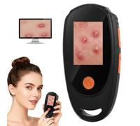 Handheld 500X Magnification Skin & Scalp Analyzer, Digital Microscope with 2" Screen