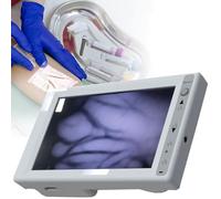 Handheld Vein Finder,LCD Shows Infrared Brightness Adjustment,for Nurses,Doctor,Elderly,Children