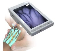 Handheld Vein Finder Viewer, Vein Locator Device for Nurses with HD Display, Aid for Venipuncture & Blood Draw in Elderly & Children
