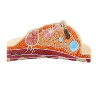 Haowul Breast Anatomical Model, Human Model Female Breast Structure Anatomical Model,Anatomy Disease Cancer Pathological Breast Model