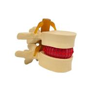 Harilla PVC Spine Teaching el | Hands-on Vertebrae el, for Classroom Instruction Presentations, musculoskeletal Educators, Bone Yellow