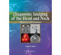 Head and Neck Imaging: MRI with CT & PET Correlations