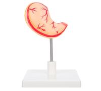 Healifty Anatomical Gastric Structure for Biology Education Precision Crafted for Medical Teaching Easy Assembly Disassembly for Students Professionals