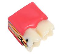 Healifty Enlarged Tooth Caries Model for Education with Detailed Decay Anatomy and Comparative Healthy Vs Decayed Teeth Teaching Tool for Clinics Schools and Patient Demonstration