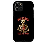 Heart Surgery My Scars Tell A Story Fun Mens Get Well Case for iPhone 11 Pro