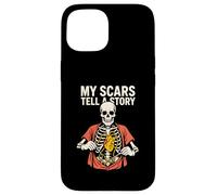 Heart Surgery My Scars Tell A Story Fun Mens Get Well Case for iPhone 15