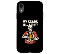 Heart Surgery My Scars Tell A Story Fun Mens Get Well Case for iPhone XR