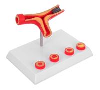 Hemobllo Anatomical Human Blood Vessel Model with Vascular Plaque and Fat Deposits, Medical Plastic Cardiovascular Model for Diabetes and Education, Clinical Teaching Tool for Medical